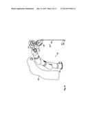 Robotic Surgery System diagram and image