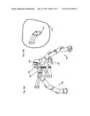 Robotic Surgery System diagram and image