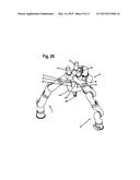 Robotic Surgery System diagram and image