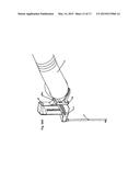 Robotic Surgery System diagram and image