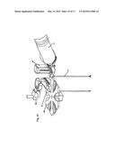 Robotic Surgery System diagram and image