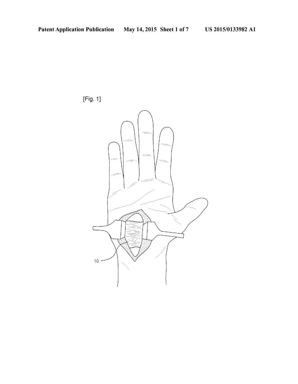 SURGICAL INSTRUMENT, AND MEDICAL KIT FOR TREATING CARPAL TUNNEL SYNDROME - diagram, schematic, and image 02