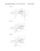 SURGICAL INSTRUMENT, AND MEDICAL KIT FOR TREATING CARPAL TUNNEL SYNDROME diagram and image