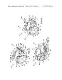 SCALPEL HANDLE HAVING A BLADE SHIELD diagram and image