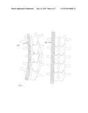 EXPANDABLE ROD SYSTEM TO TREAT SCOLIOSIS AND METHOD OF USING THE SAME diagram and image