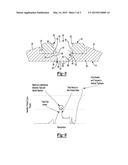 LOCKING MECHANISM FOR PECTUS BAR diagram and image