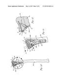 VARIABLE ANGLE BLADE PLATE SYSTEM AND METHOD diagram and image