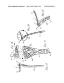 VARIABLE ANGLE BLADE PLATE SYSTEM AND METHOD diagram and image