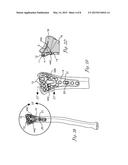 VARIABLE ANGLE BLADE PLATE SYSTEM AND METHOD diagram and image