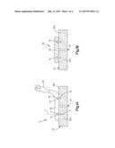 METHOD OF FIXATING TWO OR MORE ANATOMICAL BODIES diagram and image