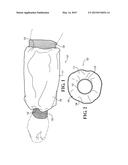 VASODILATION SLEEVE AND METHOD OF VASODILATING A LIMB diagram and image