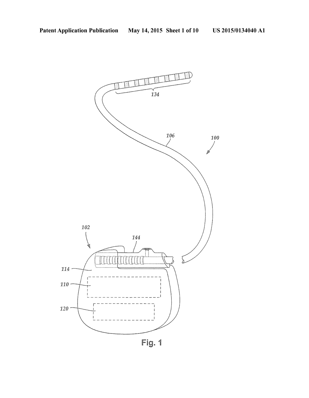 IMPLANTABLE ELECTRIC STIMULATION SYSTEM AND METHODS OF MAKING AND USING - diagram, schematic, and image 02