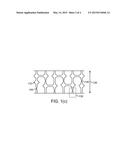 STENT HAVING CIRCUMFERENTIALLY DEFORMABLE STRUTS diagram and image