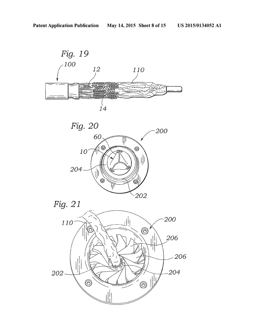 LOW PROFILE TRANSCATHETER HEART VALVE - diagram, schematic, and image 09