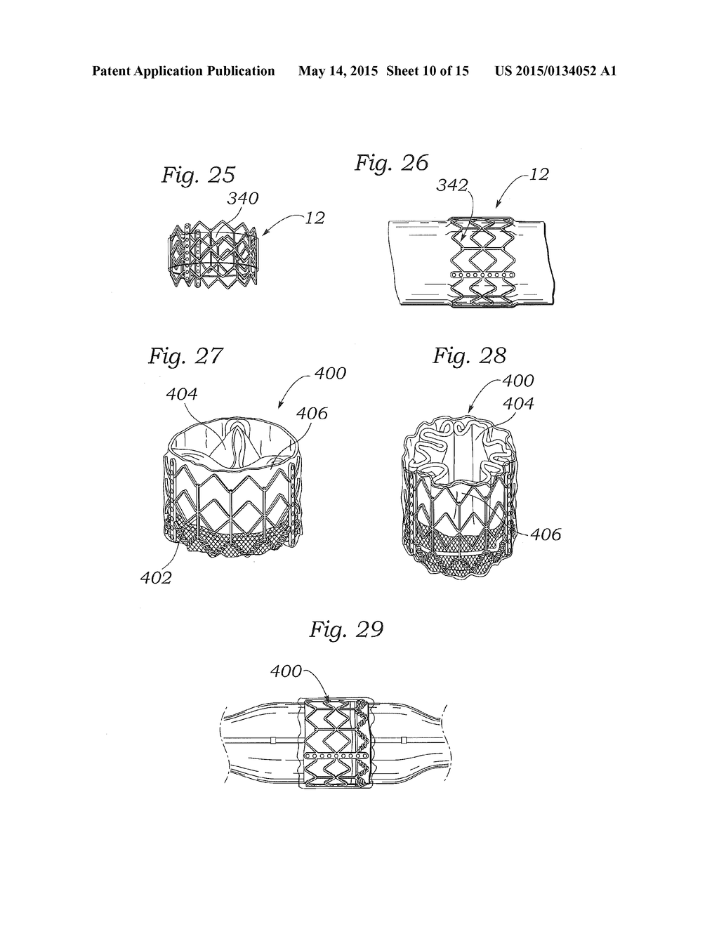 LOW PROFILE TRANSCATHETER HEART VALVE - diagram, schematic, and image 11