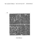 METHODS OF MODULATING THROMBOCYTOPENIA  AND MODIFIED TRANSGENIC PIGS diagram and image