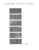 METHODS OF MODULATING THROMBOCYTOPENIA  AND MODIFIED TRANSGENIC PIGS diagram and image