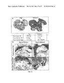 METHODS OF MODULATING THROMBOCYTOPENIA  AND MODIFIED TRANSGENIC PIGS diagram and image