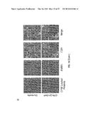 METHODS OF MODULATING THROMBOCYTOPENIA  AND MODIFIED TRANSGENIC PIGS diagram and image