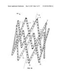 SYSTEMS AND METHODS FOR MANUFACTURING A STENT FRAME diagram and image