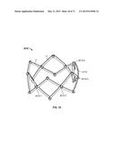 SYSTEMS AND METHODS FOR MANUFACTURING A STENT FRAME diagram and image