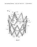 SYSTEMS AND METHODS FOR MANUFACTURING A STENT FRAME diagram and image