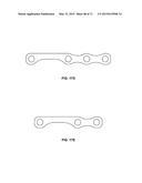 SYSTEMS AND METHODS FOR MANUFACTURING A STENT FRAME diagram and image