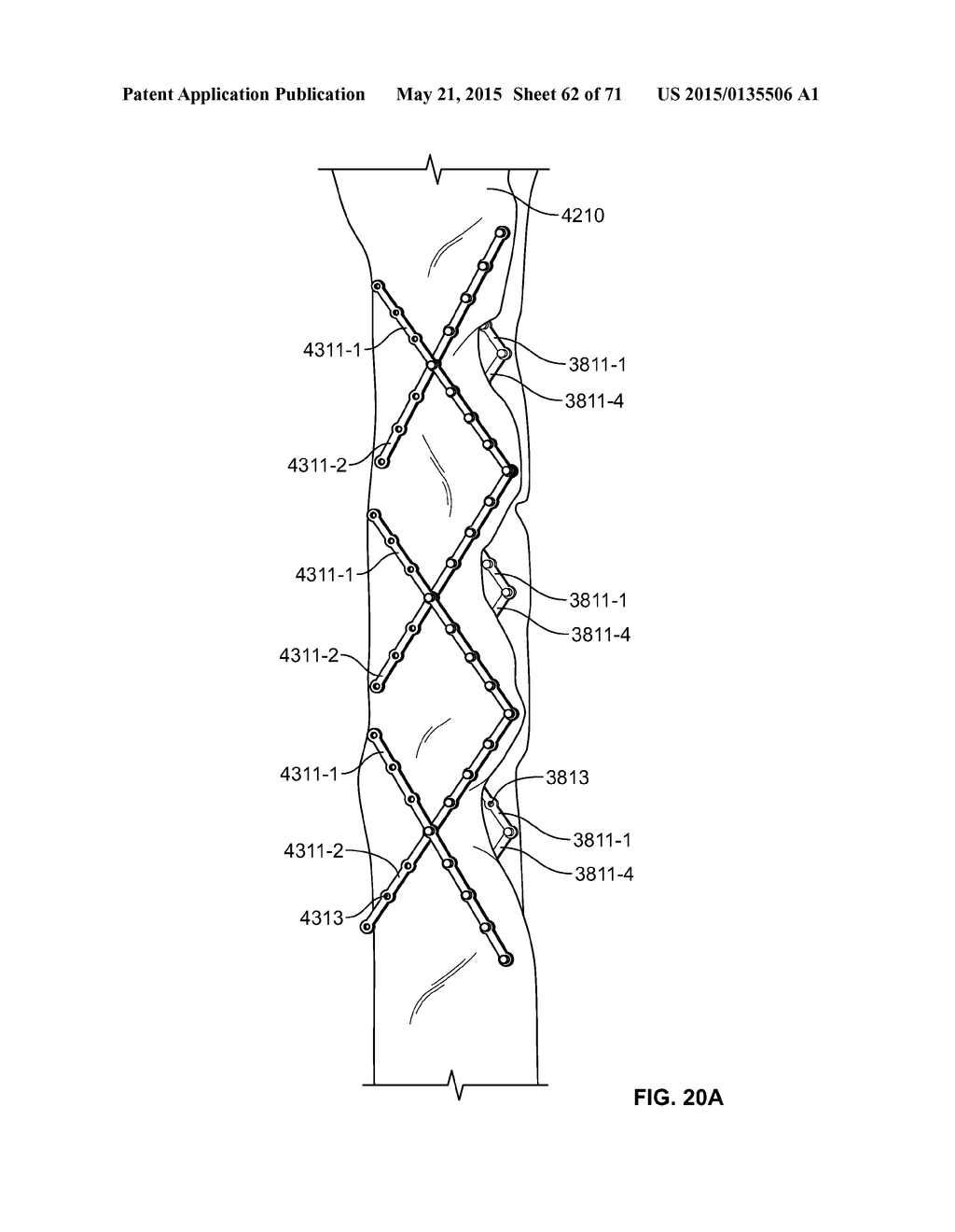 SYSTEMS AND METHODS FOR MANUFACTURING A STENT FRAME - diagram, schematic, and image 63