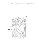 METHODS OF MAKING A DURABLE MULTI-LAYER HIGH STRENGTH POLYMER COMPOSITE     SUITABLE FOR PROSTHETIC VALVES diagram and image