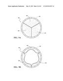 METHODS OF MAKING A DURABLE MULTI-LAYER HIGH STRENGTH POLYMER COMPOSITE     SUITABLE FOR PROSTHETIC VALVES diagram and image