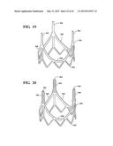 METHODS OF MAKING A DURABLE MULTI-LAYER HIGH STRENGTH POLYMER COMPOSITE     SUITABLE FOR PROSTHETIC VALVES diagram and image