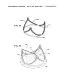 METHODS OF MAKING A DURABLE MULTI-LAYER HIGH STRENGTH POLYMER COMPOSITE     SUITABLE FOR PROSTHETIC VALVES diagram and image