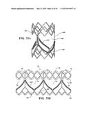 METHODS OF MAKING A DURABLE MULTI-LAYER HIGH STRENGTH POLYMER COMPOSITE     SUITABLE FOR PROSTHETIC VALVES diagram and image