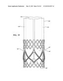 METHODS OF MAKING A DURABLE MULTI-LAYER HIGH STRENGTH POLYMER COMPOSITE     SUITABLE FOR PROSTHETIC VALVES diagram and image