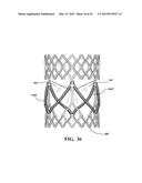 METHODS OF MAKING A DURABLE MULTI-LAYER HIGH STRENGTH POLYMER COMPOSITE     SUITABLE FOR PROSTHETIC VALVES diagram and image