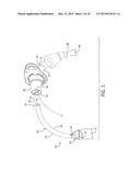 Tracheostomy Tube With Inner Cannula diagram and image