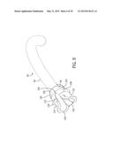 Tracheostomy Tube With Inner Cannula diagram and image