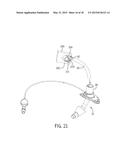 Tracheostomy Tube With Inner Cannula diagram and image