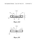 SURROUND WITH VARIATIONS OF CONCAVITY diagram and image