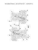 ELECTRICALLY-POWERED THERMAL-REGULATED APPAREL AND CONTROL SYSTEM THEREFOR diagram and image