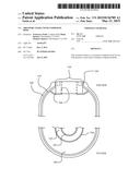 PRESSURE VESSEL WITH COMPOSITE BOSS diagram and image