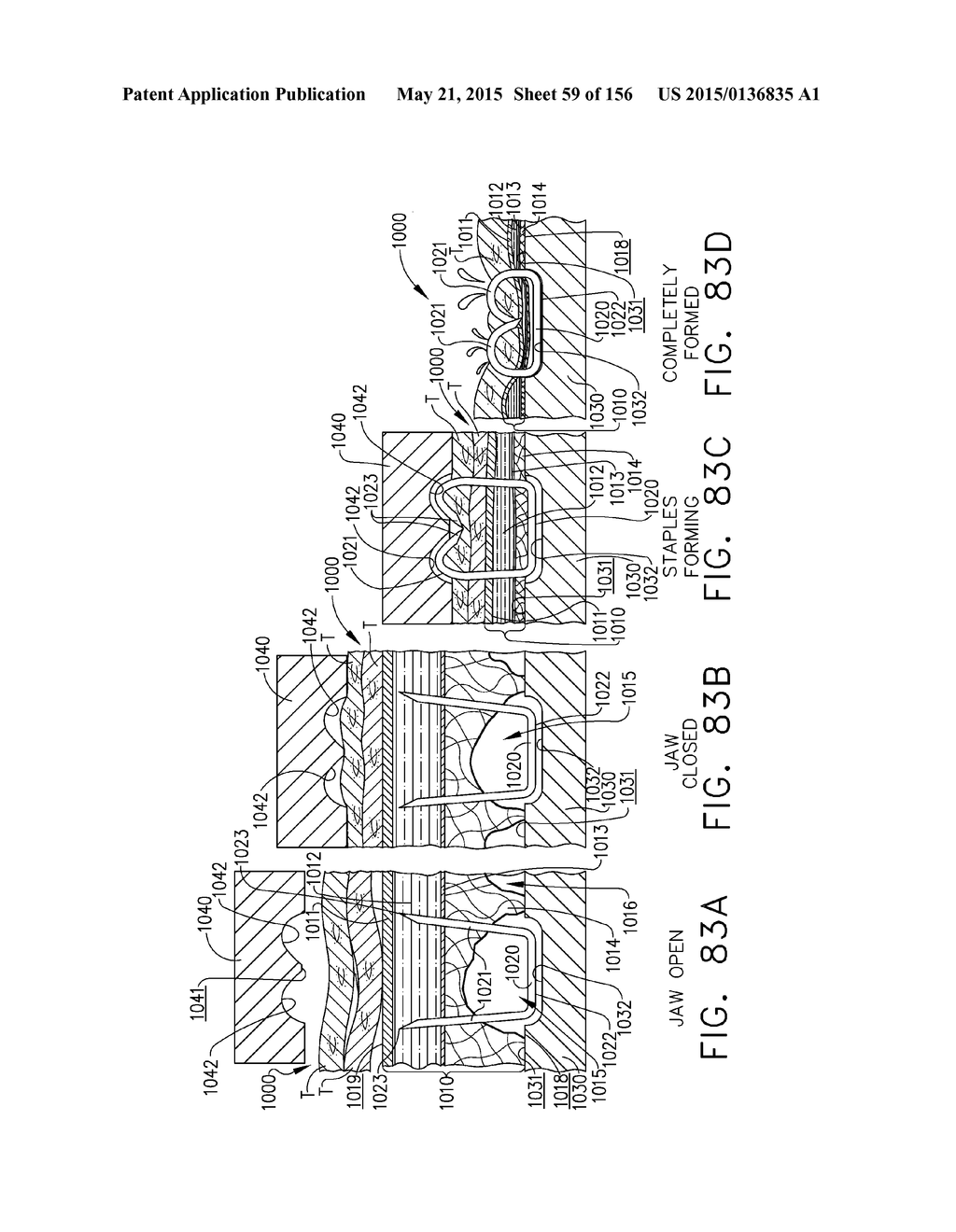 SURGICAL STAPLER WITH FLOATING ANVIL - diagram, schematic, and image 60