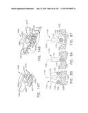 SURGICAL STAPLER WITH FLOATING ANVIL diagram and image