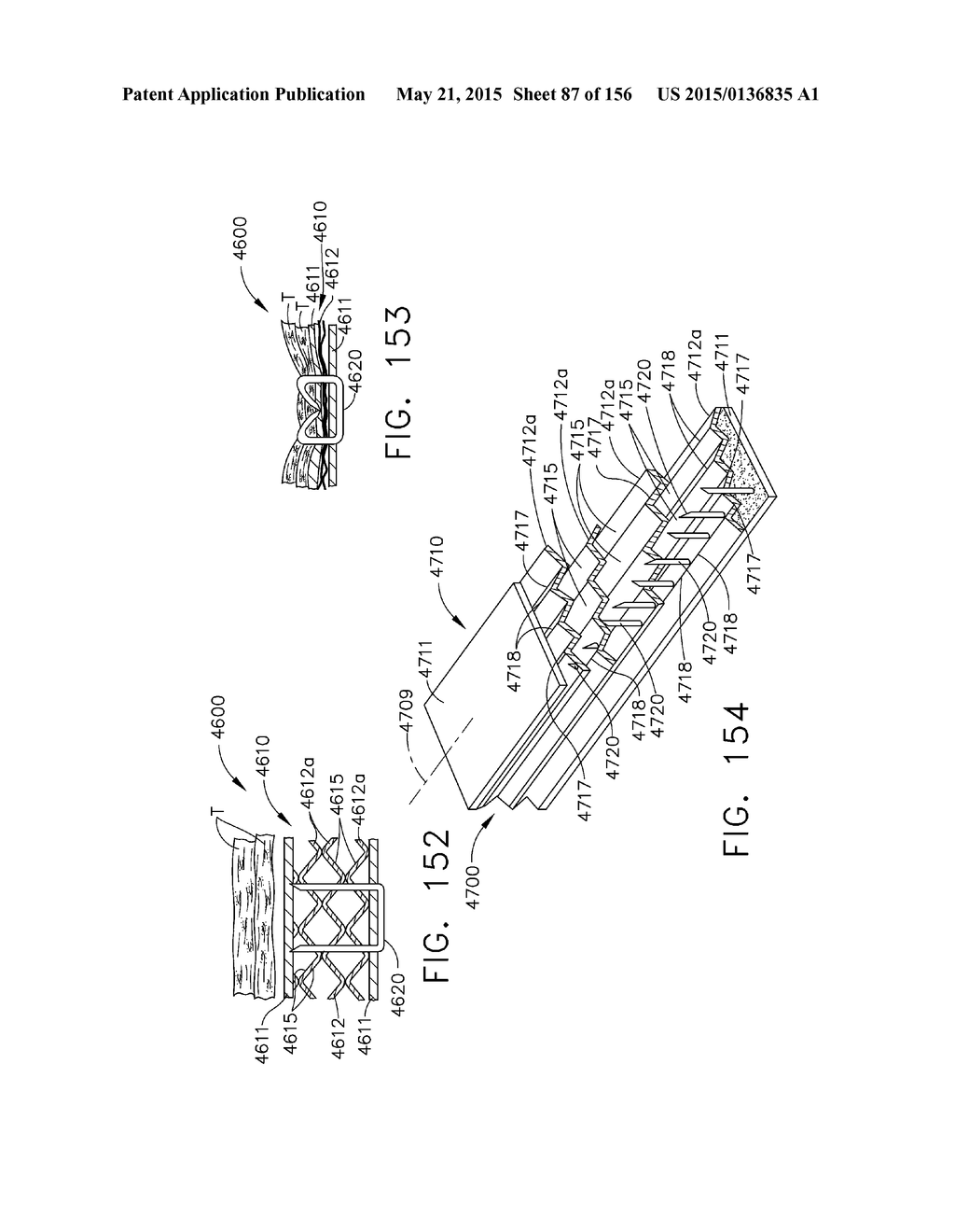 SURGICAL STAPLER WITH FLOATING ANVIL - diagram, schematic, and image 88