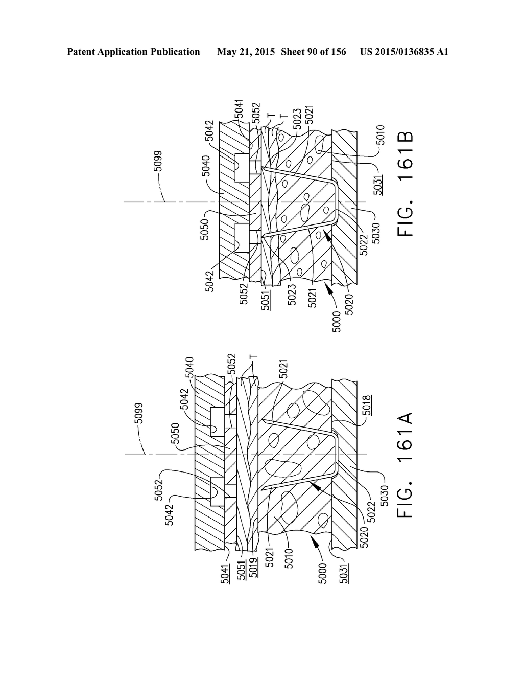 SURGICAL STAPLER WITH FLOATING ANVIL - diagram, schematic, and image 91