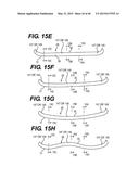 Configurable footwear sole structures controlled by a smartphone app     algorithm using sensors in the smartphone and the soles diagram and image