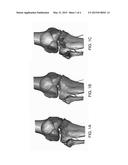 VOLUME RENDERING COLOR MAPPING ON POLYGONAL OBJECTS FOR 3-D PRINTING diagram and image