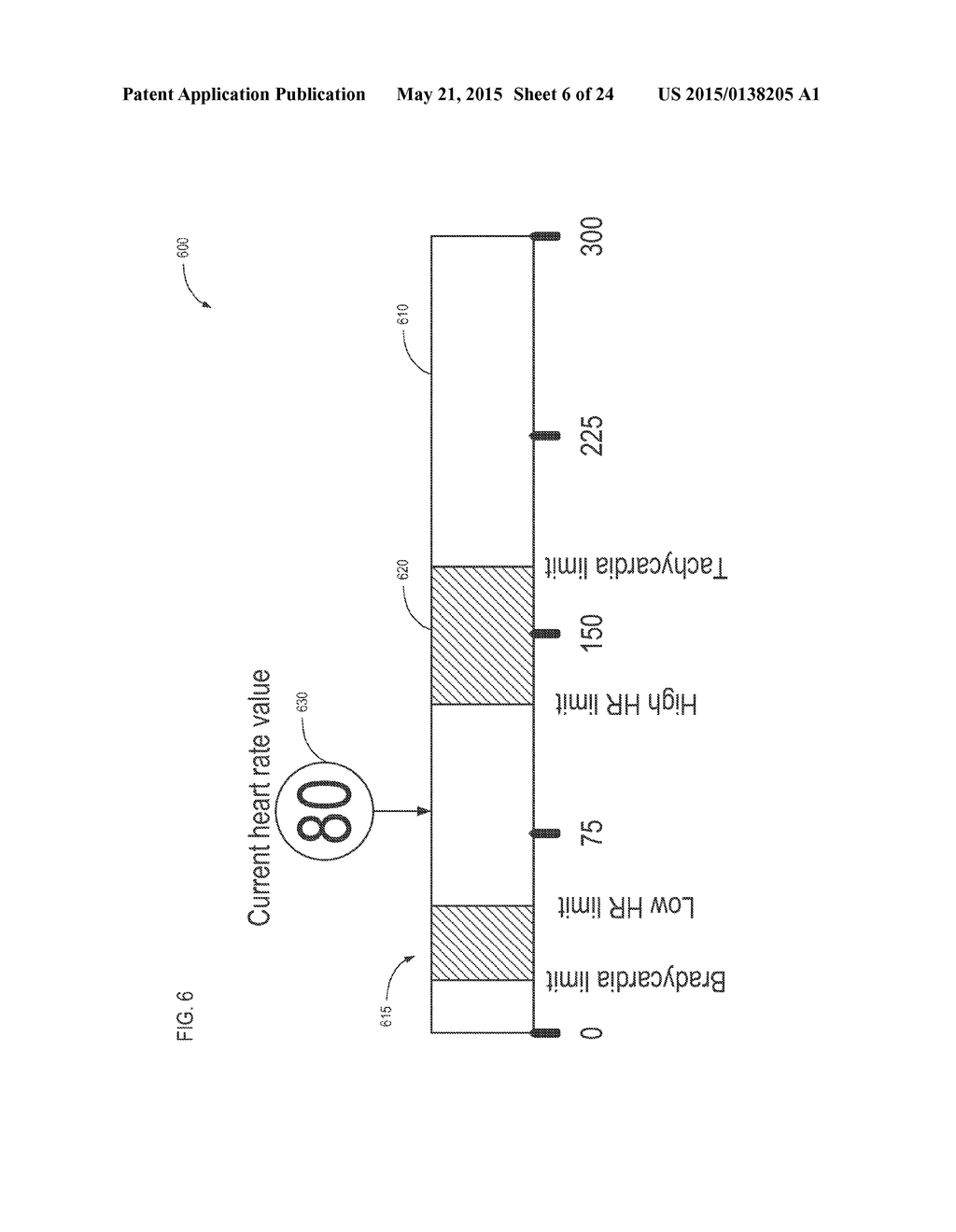 Graphical Display of Physiological Parameters on Patient Monitors - diagram, schematic, and image 07