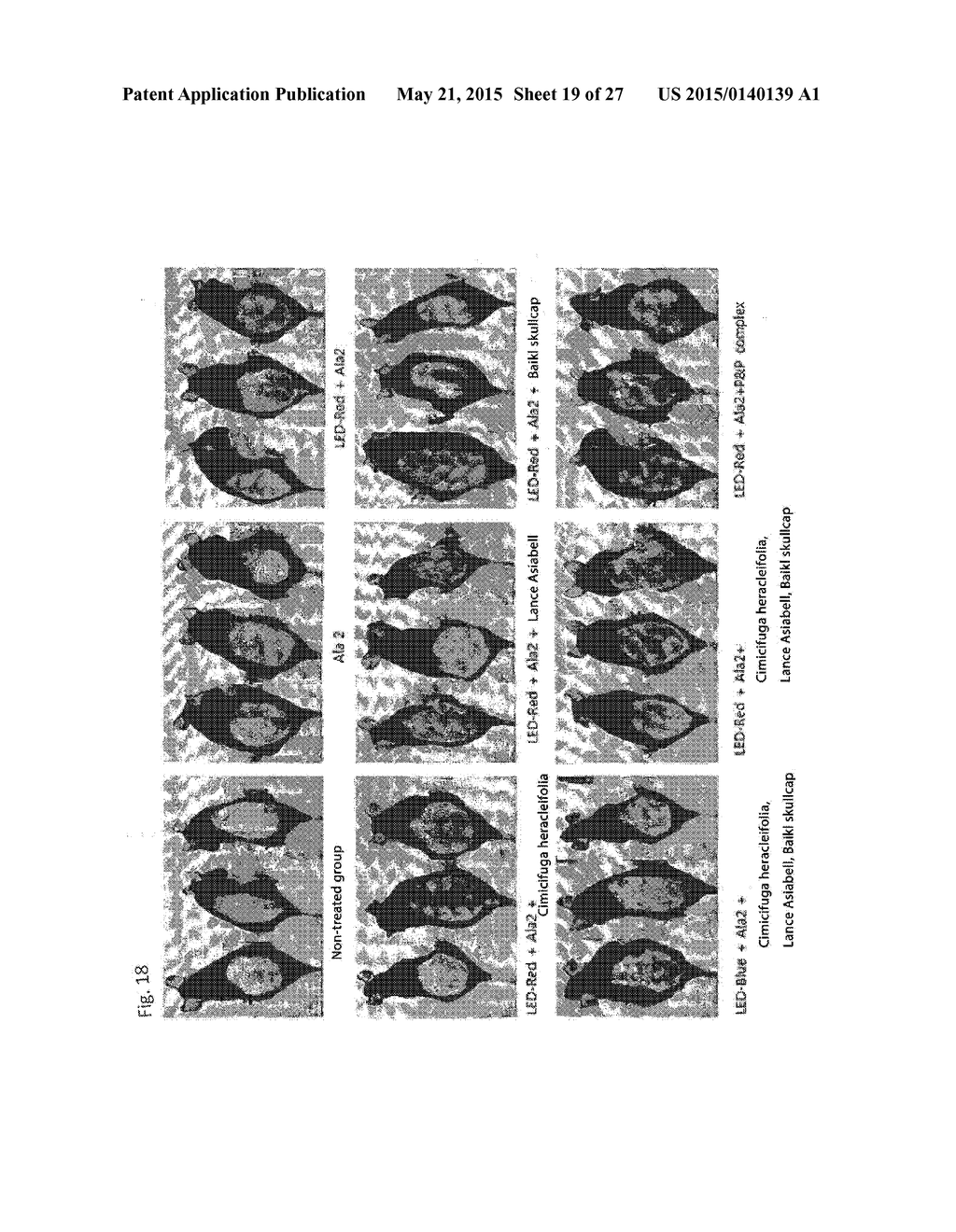 COMPOSITION FOR IMPROVING OR PROMOTING HAIR GROWTH CONTAINING, AS ACTIVE     INGREDIENTS, PHOTOSENSITIZER IRRADIATED WITH LIGHT AND PEPTIDE, AND     METHOD USING SAME - diagram, schematic, and image 20