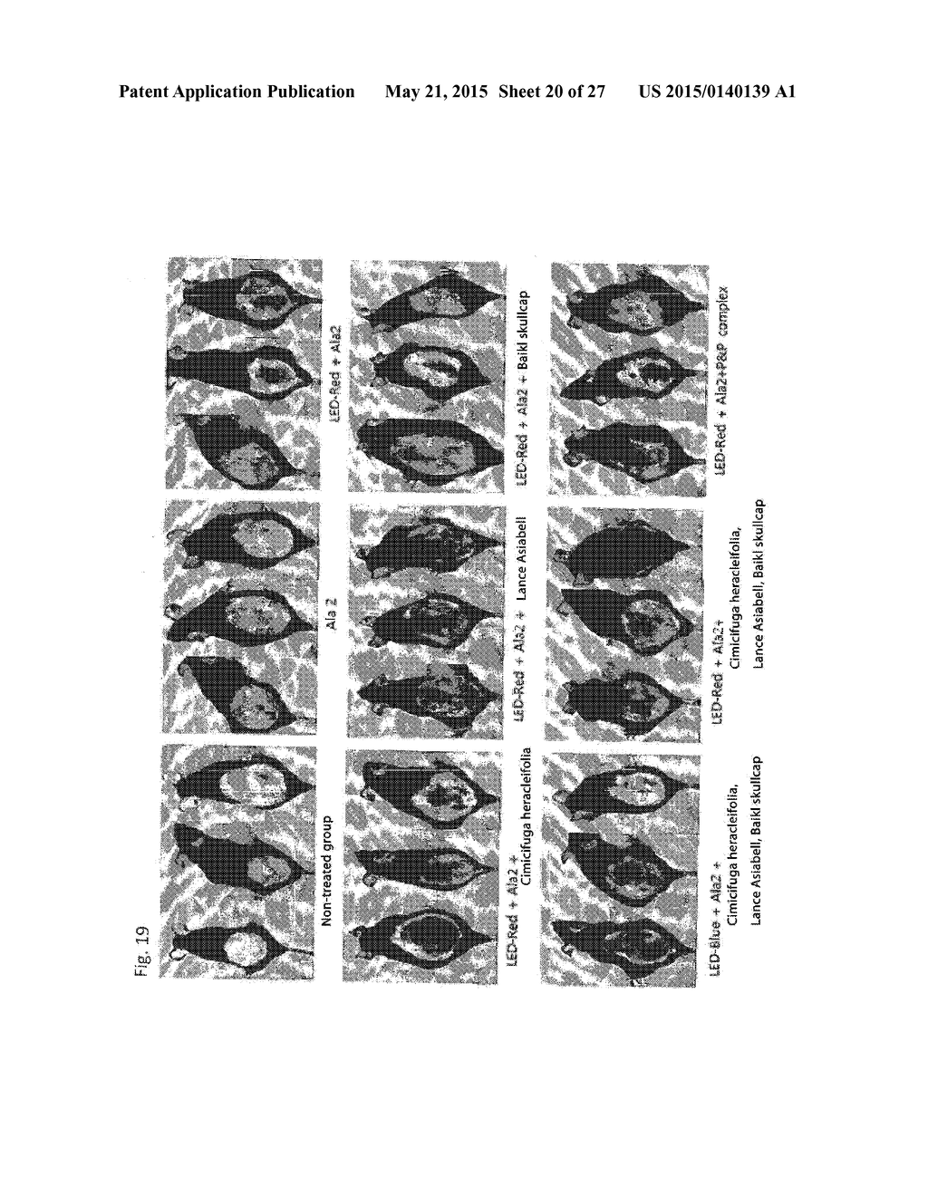 COMPOSITION FOR IMPROVING OR PROMOTING HAIR GROWTH CONTAINING, AS ACTIVE     INGREDIENTS, PHOTOSENSITIZER IRRADIATED WITH LIGHT AND PEPTIDE, AND     METHOD USING SAME - diagram, schematic, and image 21